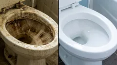 WC brillante senza costosi prodotti chimici: 5 modi economici per rimuovere rapidamente le macchie difficili