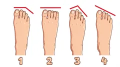 Che tipo di piede hai? Romano, greco, egizio o quadrato: cosa racconta (e cosa no) di te